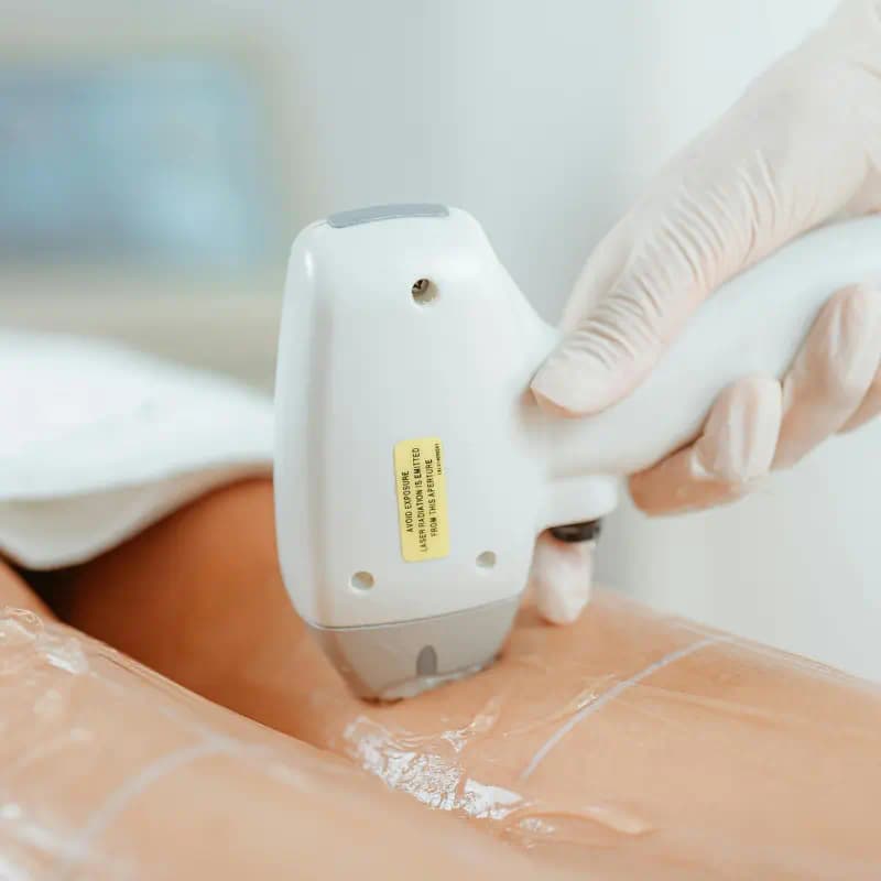 Moderne Laser Haarentfernung mit Diodenlaser im GK Cosmetic Studio Schönbühl — dauerhaft und schonend